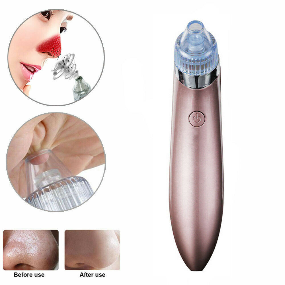 Electric Blackhead Vacuum Pore Cleaner/Remover