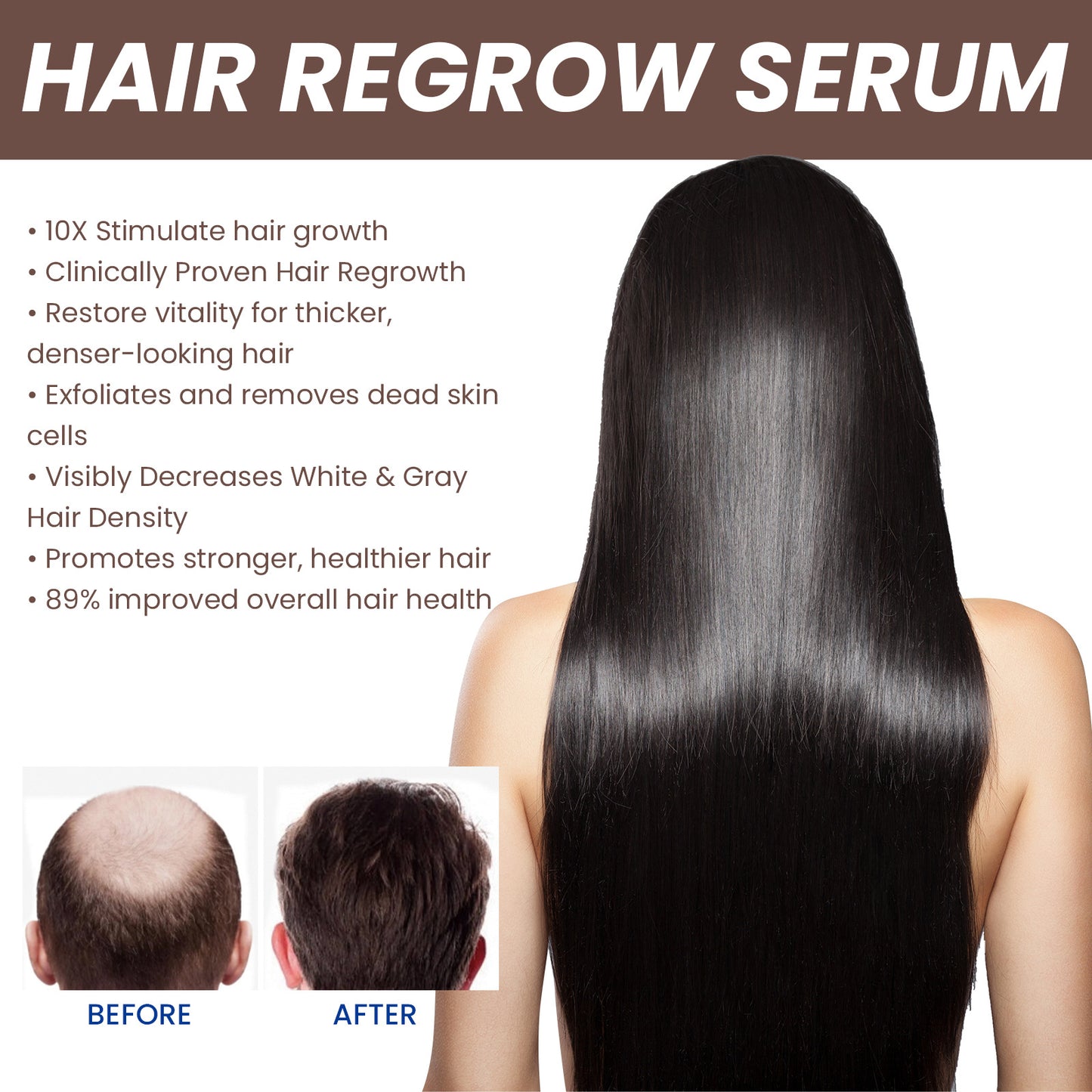 EELHOE - Hair Regrowth Serum