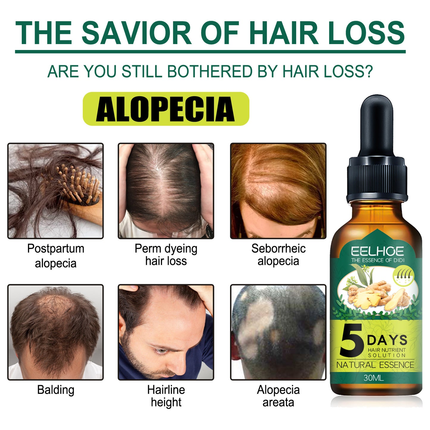 Eelhoe - Ginger Hair Essential Oil