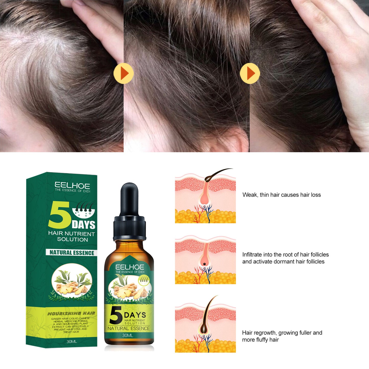 Eelhoe - Ginger Hair Essential Oil