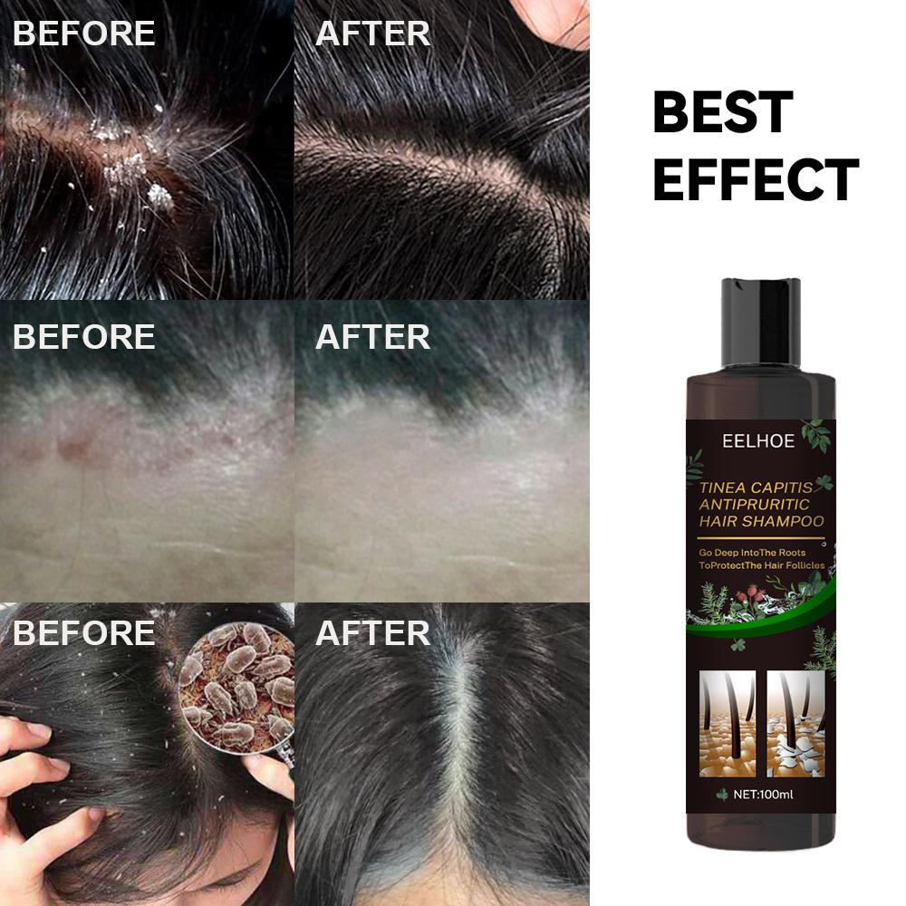 EELHOE - Anti-Dandruff Shampoo