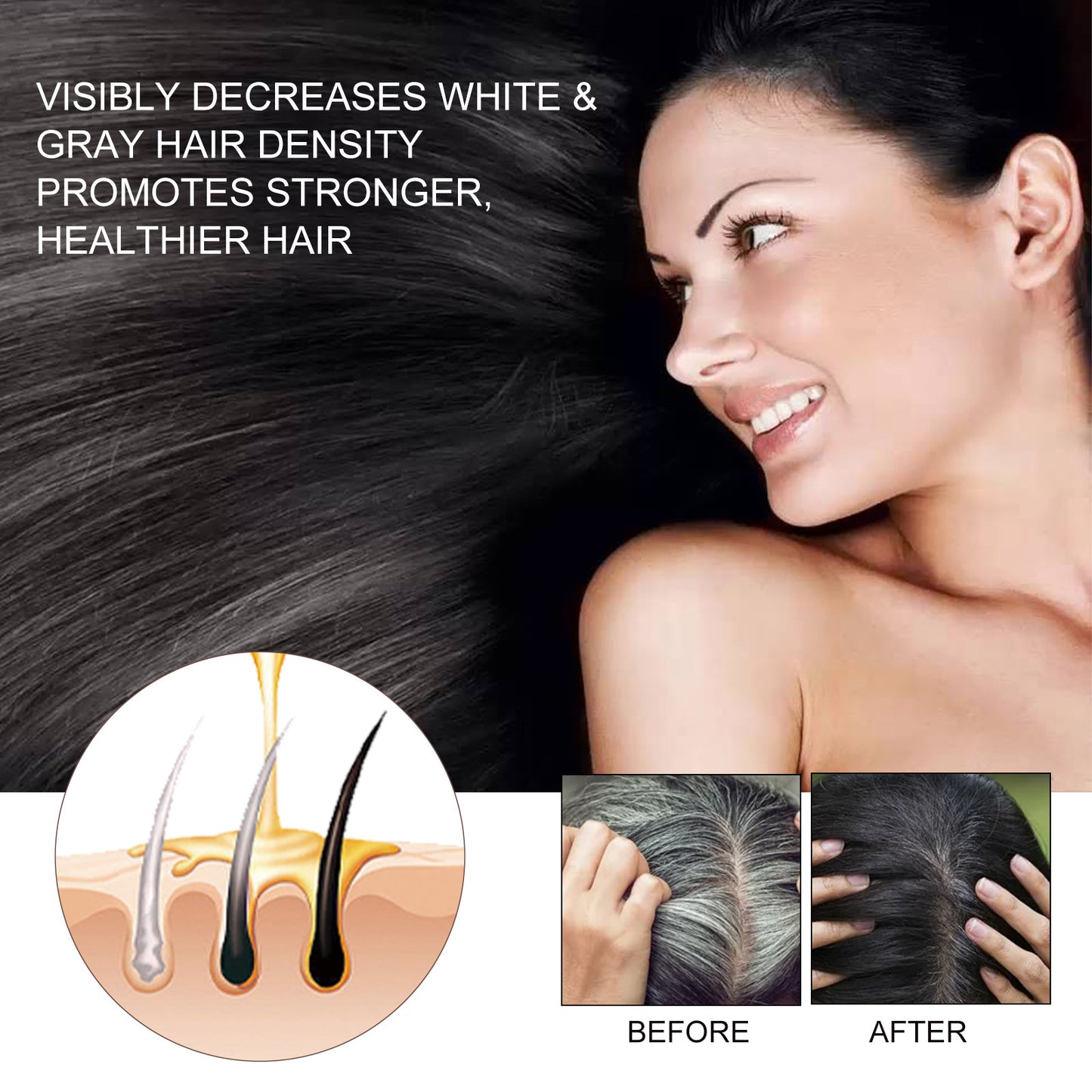 EELHOE - Hair Regrowth Serum