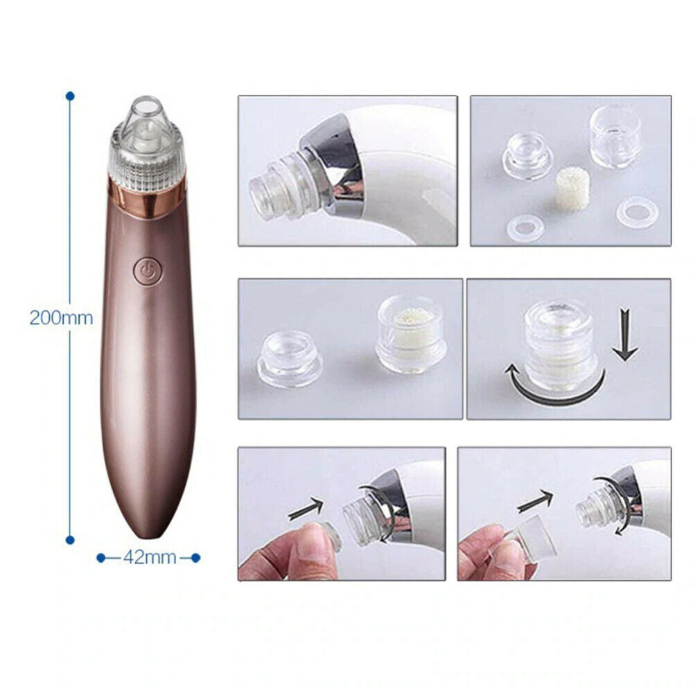 Electric Blackhead Vacuum Pore Cleaner/Remover