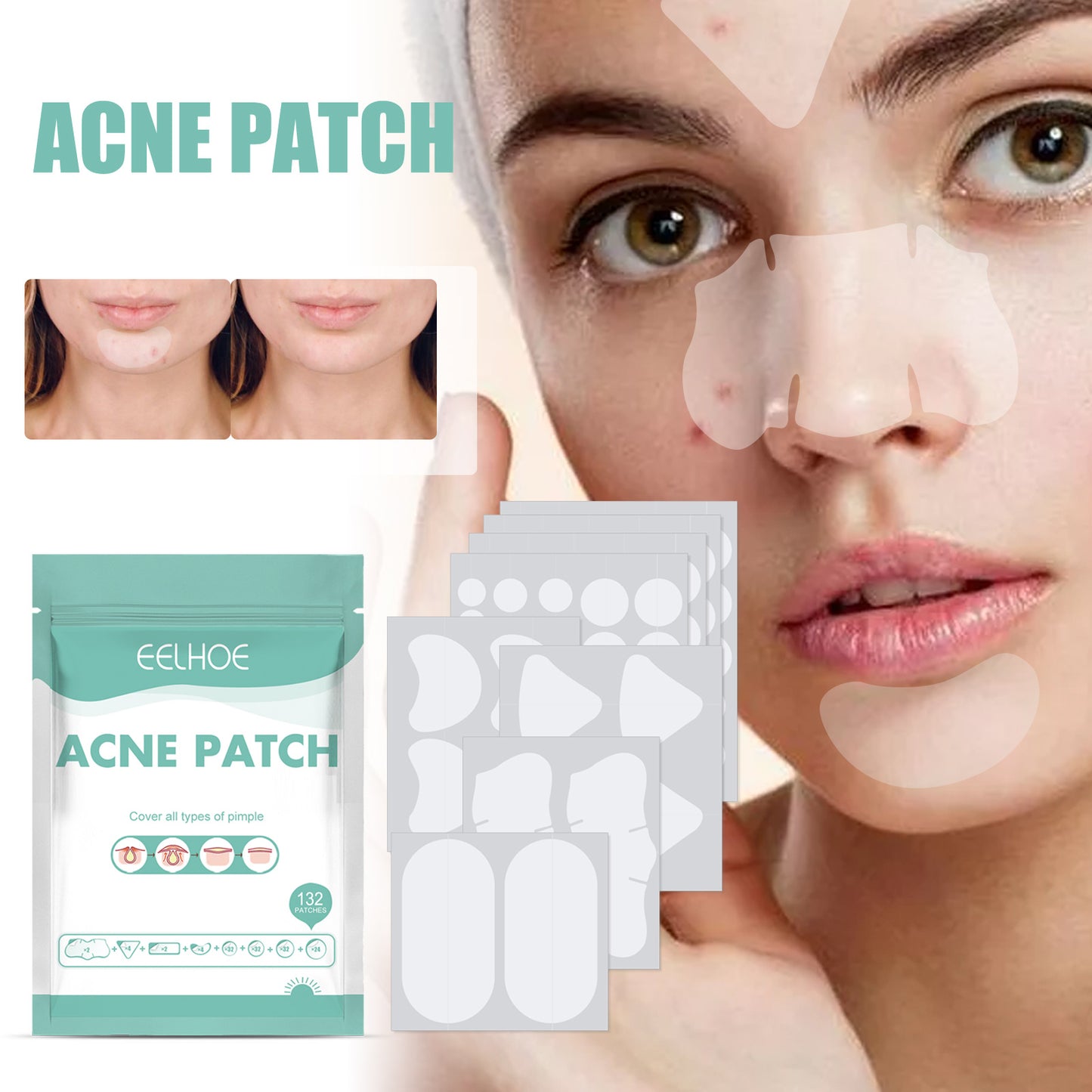 EELHOE - Acne Relief Mask Patch