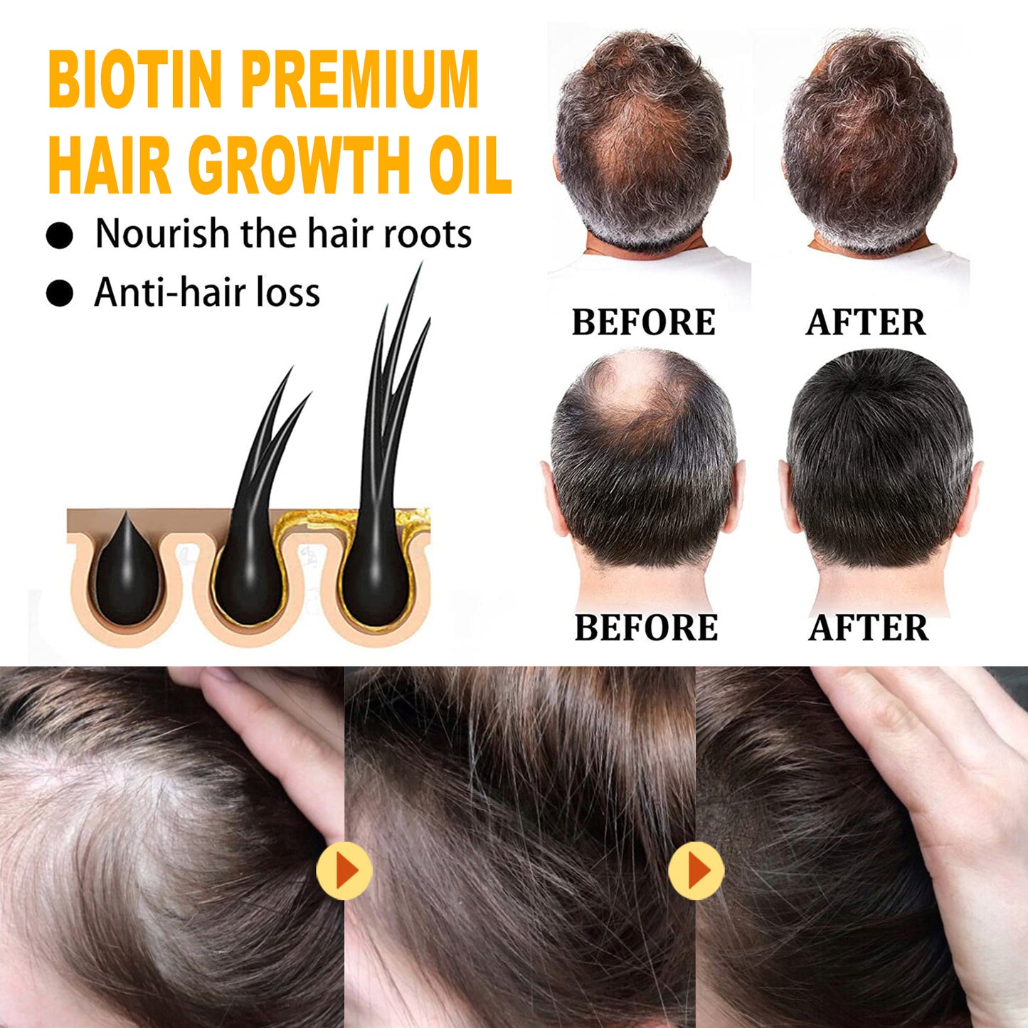EELHOE - Biotin Hair Growth Oil