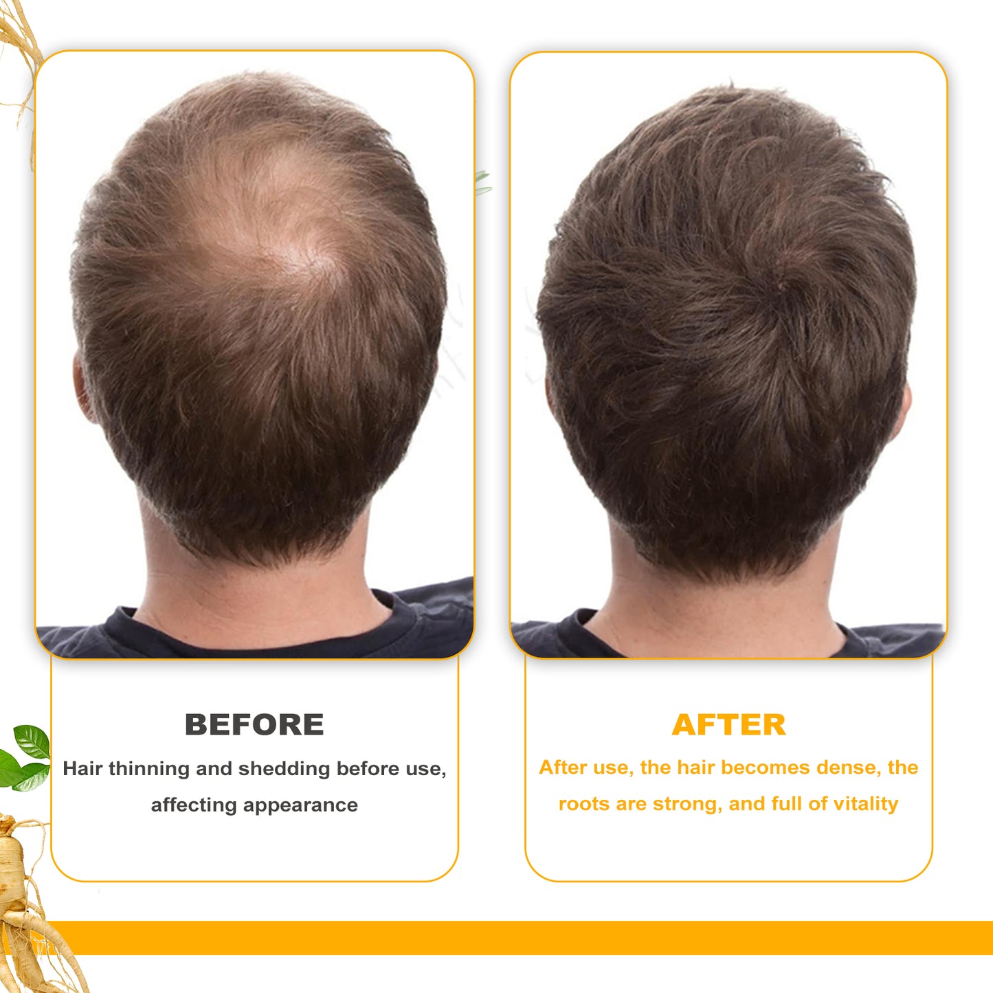 EELHOE - Biotin Hair Growth Oil
