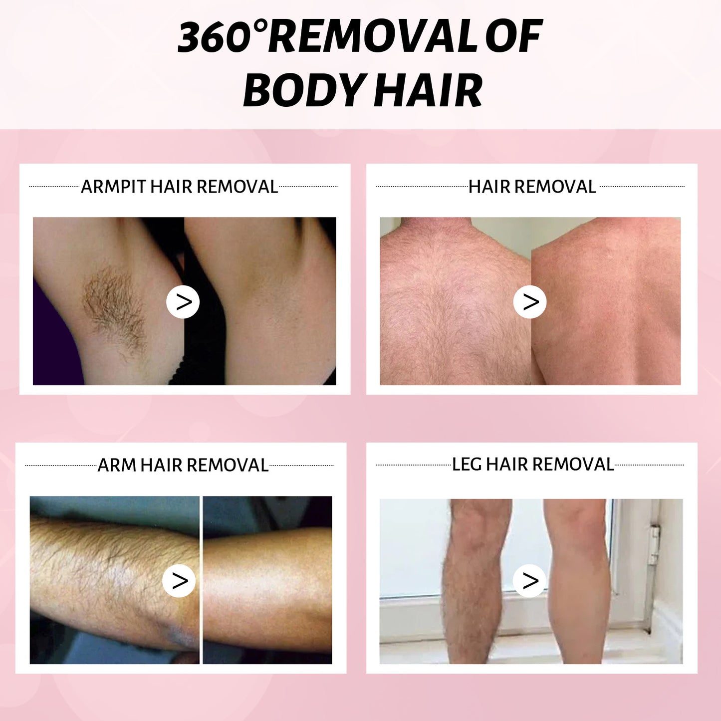 EELHOE - Hair Removal Spray