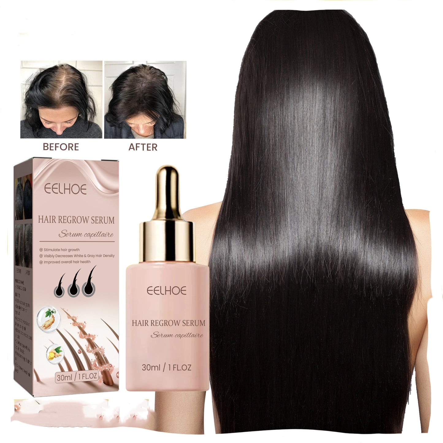 EELHOE - Hair Regrowth Serum