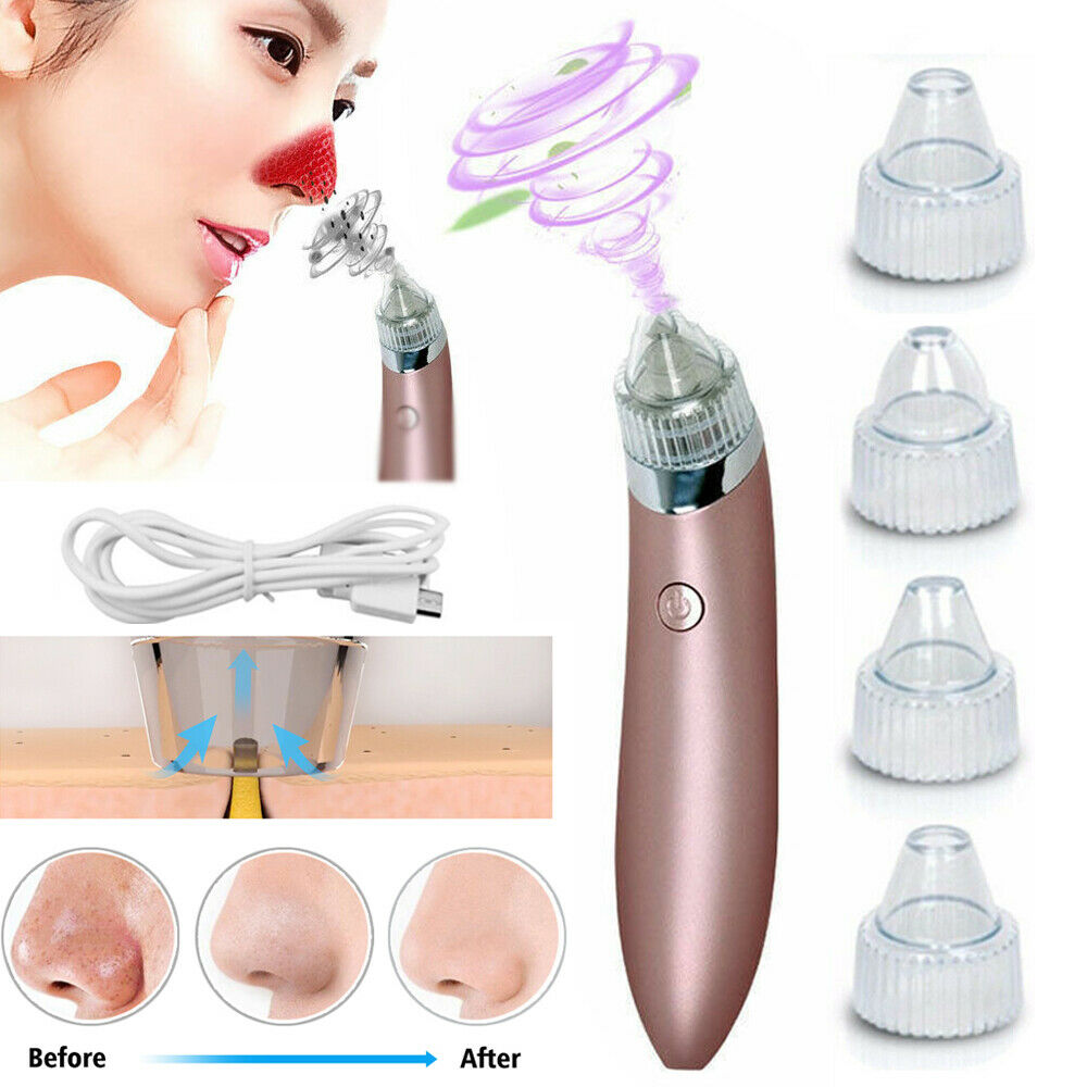 Electric Blackhead Vacuum Pore Cleaner/Remover