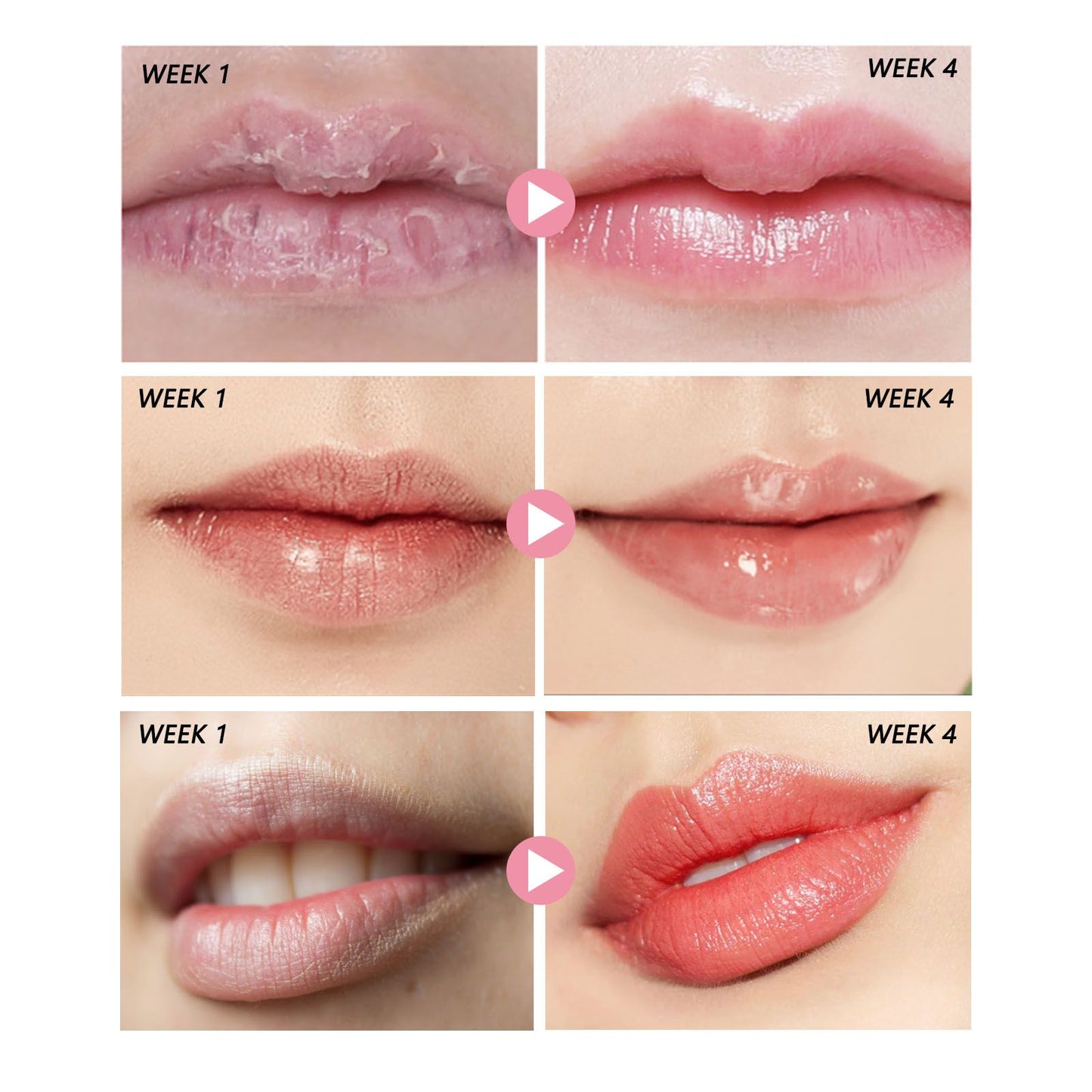 EELHOE Peach Lip Scrub For Fading Lip Lines